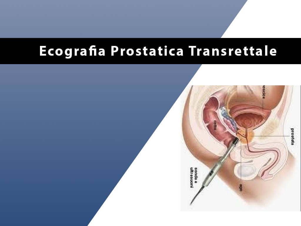 Ecografia Prostatica Transrettale